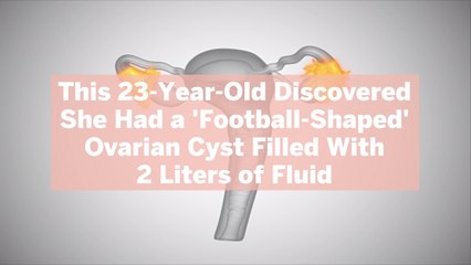 This 23-Year-Old Discovered She Had a 'Football-Shaped' Ovarian Cyst Filled With 2 Liters