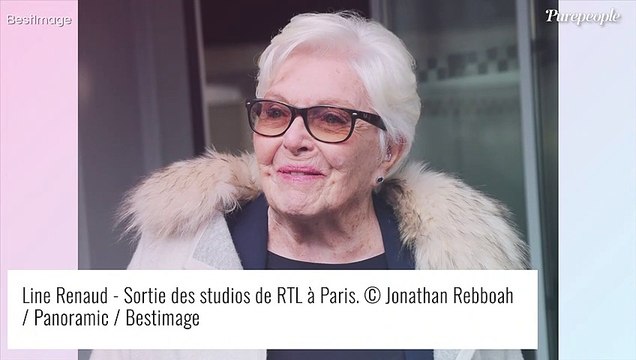 Line Renaud a cédé à la chirurgie esthétique... et retouché son visage : Ça a pris une demi-heure !