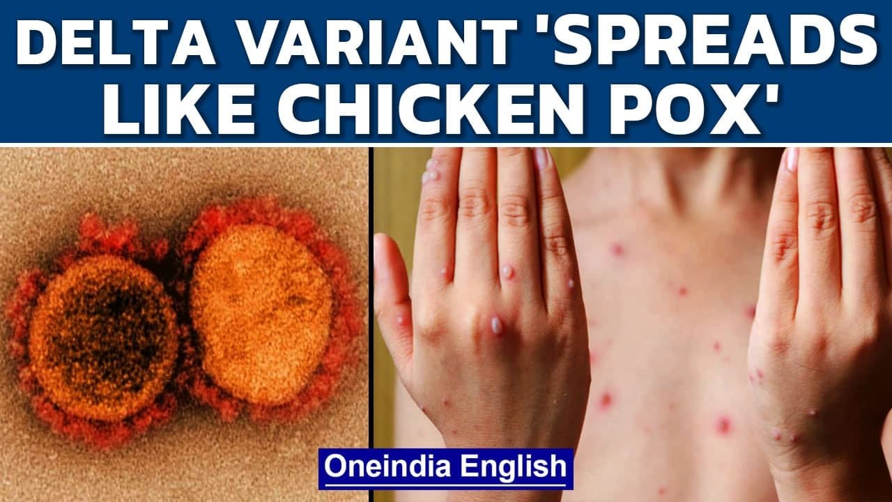 Delta variant spreads like chicken pox, causes more severe disease: Report | Oneindia News