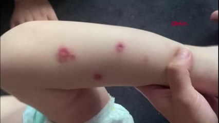 ŞİŞLİ'DE 2 YAŞINDAKİ BEBEĞİNE İŞKENCE YAPTIĞI İDDİA EDİLEN BABA TUTUKLANDI