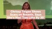 Chrissy Teigen Shows Scars on Breasts, Says She's Had 'Two Lifts By 35' In New Instagram Video
