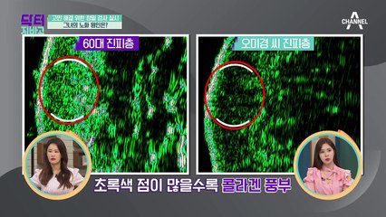 노화의 원인은 이것?! 주름, 탈모, 골밀도에 모두 영향을 주는 이것은 바로?!