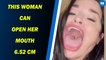 This woman can open her mouth 6.52 cm, sets Guinness World Record