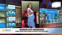 NYU Langone gynecologist Dr. Taraneh Shirazian on ovarian cyst awareness