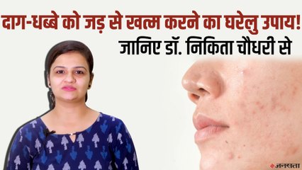 एक्ने और मुहासे के दाग हटाने के घरेलू उपाय? जानिए डॉ. निकिता चौधरी से | Skin Marks Home Treatment