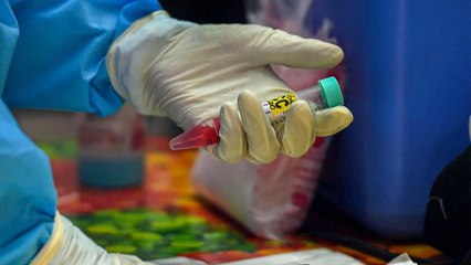 Maharashtra reports first Zika virus case, know the symptoms