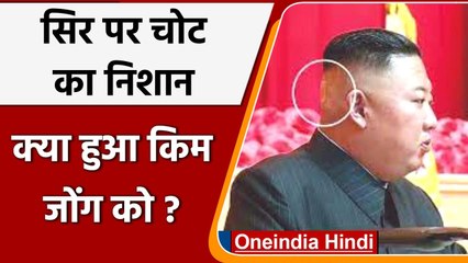 Kim Jong के सिर पर पट्टी, क्या बेहद बीमार हैं North Korea के नेता की हालत ? | वनइंडिया हिंदी