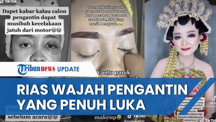 Viral Video MUA Rias Wajah Pengantin Luka-luka karena Kecelakaan, Sempat Takut Mempelai Merasa Sakit