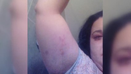 Pamela, una nueva víctima de la violencia machista; "A mi hija me la han traído desfigurada"