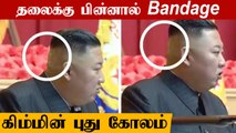Kim Jong Un Bandage Head Mystery | Oneindia Tamil