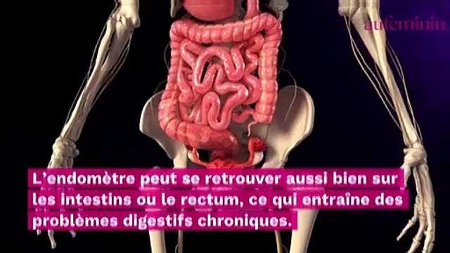 Endométriose : ces symptômes hors cycles menstruels dont on ne parle pas assez