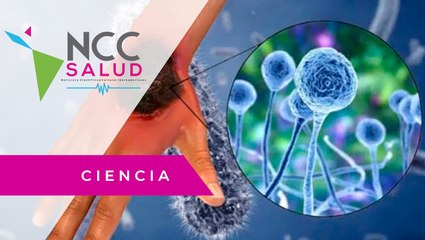 El hongo negro tiene una alta incidencia en quienes padecen COVID-19