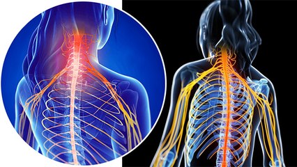 Blocked Nerve सिर्फ कुछ ही दिनों में खुल जाएगी,ना सर्जरी ना दवाइयां खाने की जरूरत । Boldsky