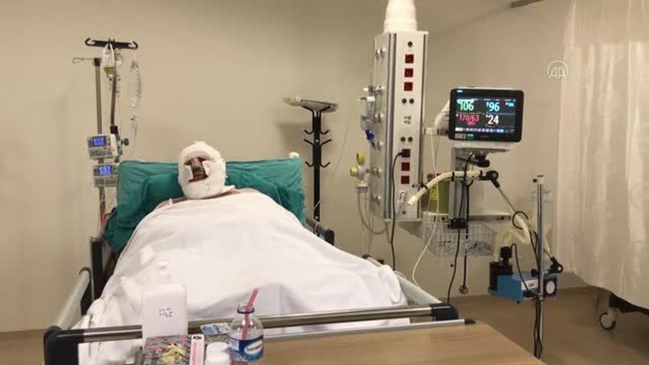 Son dakika... ESKİŞEHİR - Denizli'deki orman yangınında alevler arasında kalan orman muhafaza memuru Kozakbaş yaşadıklarını anlattı