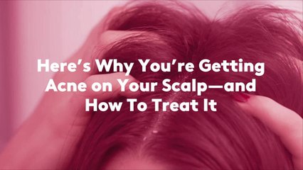 Here's Why You’re Getting Acne on Your Scalp—and How To Treat It