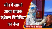 China में नई बीमारी, सामने आया घातक Anthrax Pneumonia का पहला केस | वनइंडिया हिंदी