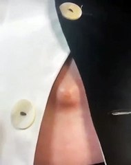 "Querem ver algo nojento?", diz Katy Perry antes de mostrar umbigo