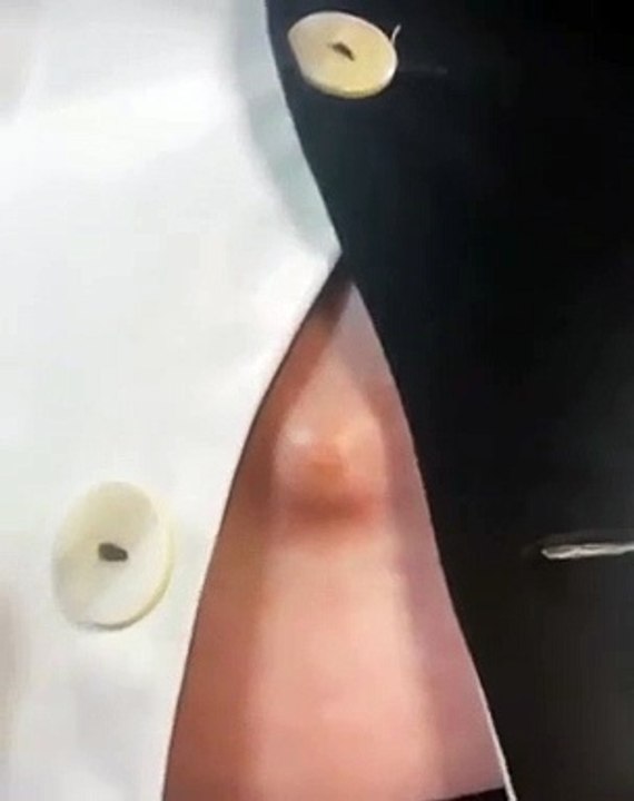 "Querem ver algo nojento?", diz Katy Perry antes de mostrar umbigo