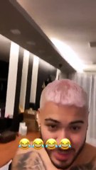Kevinho queda de cabelo após usar produto