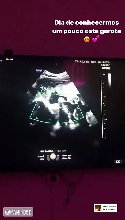 Vídeo: Cláudia Vieira mostra imagens inéditas de ecografia