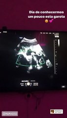 Vídeo: Cláudia Vieira mostra imagens inéditas de ecografia