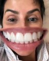 Deborah Secco responde a críticas sobre os seus dentes