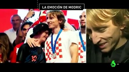Modric, menino sindrome de down