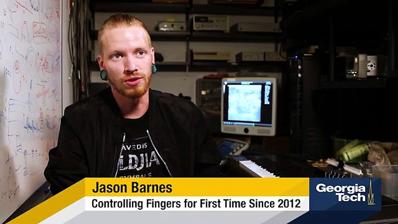 Prótese robótica permite a músico voltar a tocar piano