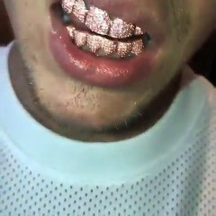 Justin Bieber gasta 13 mil euros em… grillz