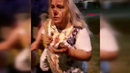 ÇOCUK PARKINDA PİTBULL DEHŞETİ