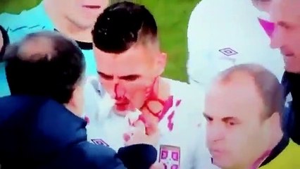 Avançado da Sérvia fica 'sem nariz'