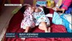 Ortu Bayi Kembar Siam Bingung Cari Biaya Operasi 1 Miliar