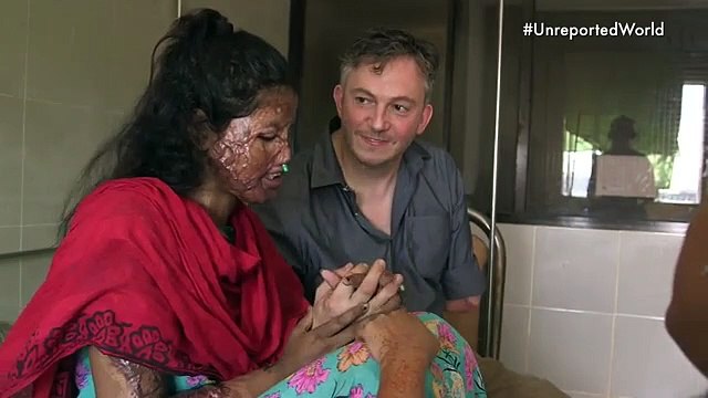 Shumi, a jovem cheia de sonhos que acabou queimada pelo namorado