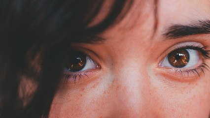 Kantung Mata Menghitam? Gunakan 3 Bahan Alami Ini!