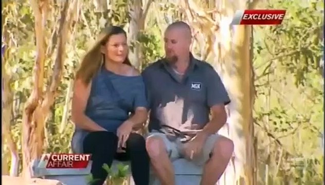 Mulher vai dar à luz bebé com duas cabeças