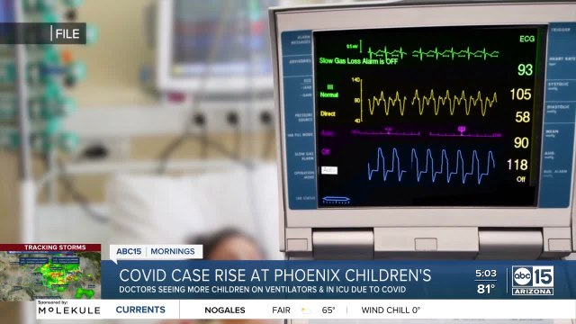 Phoenix Children's specialist weighs in as hospital deals with more kids on ventilators, in ICU