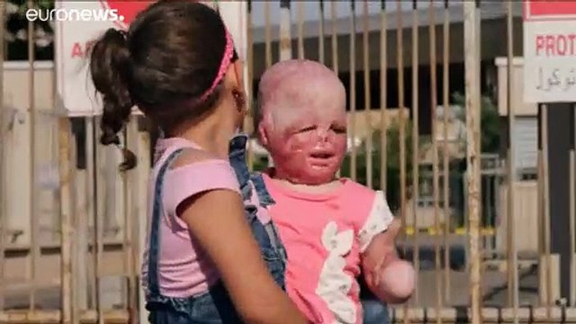 Syrisches Wunderbaby wieder mit seiner Familie vereint