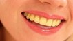 दांतों का रंग बताता है कि कितने बीमार है आप,जानें किस रंग के दांत होते हैं सबसे ज्यादा हेल्दी
