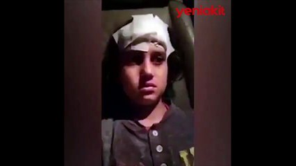 Altındağ'daki provokasyonda yüzü kanlar içinde kalan Suriyeli kız çocuğu: Beni öldürmeyin!