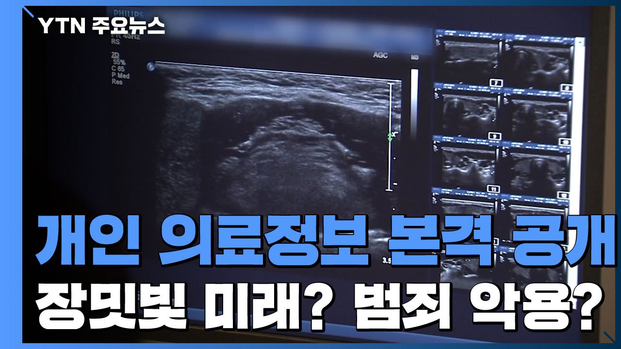 장밋빛 미래? 범죄 악용?...개인 의료정보 본격 공개 / YTN