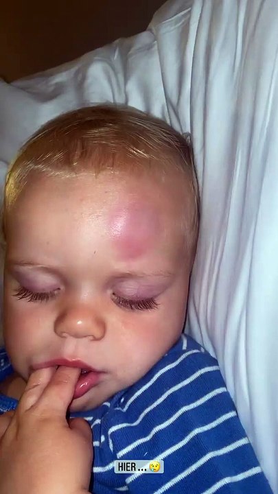 Hillary (Mamans & Célèbres) révèle que son fils Milo s'est blessé en vacances à Mykonos.