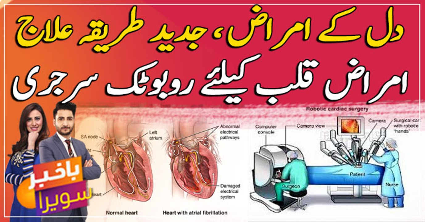 Modern treatment for heart disease Robotic surgery.....