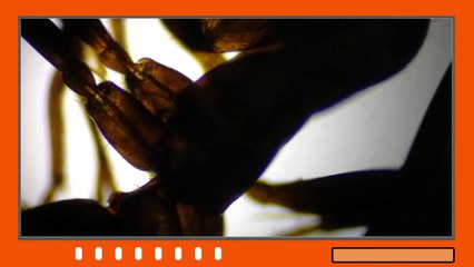 How red ant looks under microscope? is this fire ant?