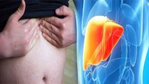 इन लोगों को है Liver Cirrhosis का ज्यादा खतरा, इन Symptoms को ना करें Ignore | Boldsky