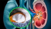Kidney Stone का नमक से बढ़ सकता है खतरा, जानें क्या है इसके Symptoms | Boldsky