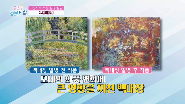 방심은 금물! 실명까지 부르는 ‘3대 눈 질환’ ✓ TV CHOSUN 210818 방송