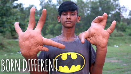 The Teen With The Giant Hands | BORN DIFFERENT