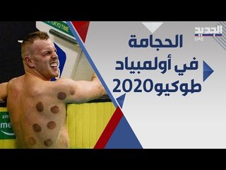 حجامة السباحين تخطف الاضواء في اولمبياد طوكيو .. لماذا يلجا اليها الرياضيون؟