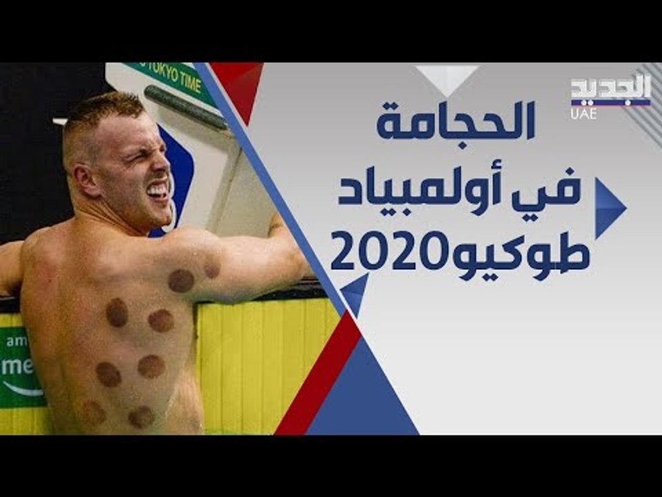 حجامة السباحين تخطف الاضواء في اولمبياد طوكيو .. لماذا يلجا اليها الرياضيون؟