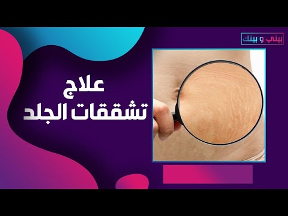 عالجي تشققات الجلد قبل موعد عرسك .. بمواد طبيعية و غير مكلفة !